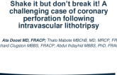 TCT 651: Shake It But Don’t Break It! A Challenging Case Of Coronary Perforation Following Intravascular Lithotripsy