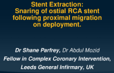 TCT 624: Stent extraction: Snaring and removal of ostial right coronary stent following proximal migration on deployment