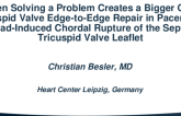 TCT 706: When Solving a Problem Creates a Bigger One: Tricuspid Valve Edge-to-Edge Repair in Pacemaker Lead-Induced Chordal Rupture of the Septal Tricuspid Valve Leaflet