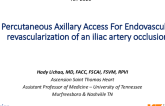 TCT 592: Percutaneous Axillary Access For Endovascular Iliac Artery Revascularization, Including CO2 Angiography, IVUS Based Re-Entry and Lithoplasty, In The Setting Of Bilateral Hostile Groins