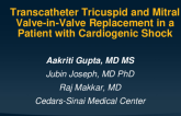 TCT 702: Transcatheter mitral and tricuspid valve-in-valve replacement in a patient with bioprosthetic mitral and tricuspid valve stenoses presenting with shock