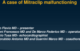 TCT 698: A Case of Mitraclip Malfunctioning