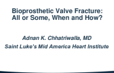 Bioprosthetic Valve Fracture: All or Some, When, and How?