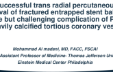 TCT 625: Successful trans radial percutaneous retrieval of fractured entrapped stent balloon inside right coronary artery deployed stent after fracture…