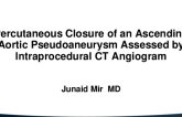 TCT 521: Percutaneous Transcatheter Closure of an Ascending Aortic Pseudoaneurysm Assessed by Intraprocedural CT Angiogram