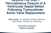 TCT 707: Beyond The Wall – Percutaneous Closure of A Ventricular Septal Defect Following Transcatheter Aortic Valve Replacement