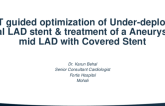 TCT 637: OCT Guided Optimization of Malapposed Ostial LAD/LM Stent & Treatment of  Aneurysm in Mid LAD With Covered Stent