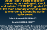 TCT 524: Acute Type A Aortic Dissection Presenting As Cardiogenic Shock And Anterior STEMI…