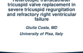 TCT 704: Heterotopic Transcatheter Tricuspid Valve Replacement in Severe Tricuspid Regurgitation and Refractory Right Ventricular Failure  