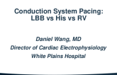 RV vs His vs LBBB Pacing