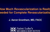 How Complete Does Complete Revascularization Really Need to Be?