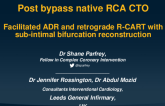 Post Bypass Native RCA CTO: Facilitated ADR and Retrograde R-CART With Sub-Intimal Bifurcation Reconstruction
