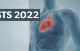 sts 2022