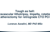 Tough as Hell: Intravascular Lithotripsy, Mechanical Circulatory Support, and Atherectomy for Retrograde CTO PCI