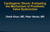 Valvular Cardiogenic Shock - Evaluating the Mechanism of Prosthetic Mitral Valve Stenosis