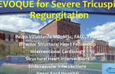 EVOQUE for Severe Tricuspid Regurgitation