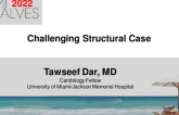 Challenging Structural Case