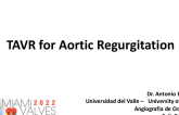 TAVR for Aortic Regurgitation