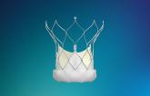 Next-Generation Navitor Valve Shows Promise in High-risk TAVI Patients