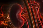 Registry Data Hint at MACE Benefit with Renal Denervation