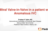 Trans Jugular Mitral Valve-In-Valve in Patient With Anomalous Inferior Vena Cava