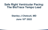 Safe Right Ventricle Pacing: The BioTrace Tempo Lead