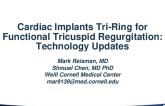 Cardiac Implants Tri-Ring for Functional Tricuspid Regurgitation: Technology Updates