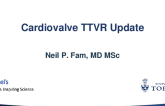 Cardiovalve Valve