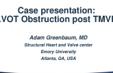 #2 Case Presentation: Acute LVOT Obstruction Post-TMVR