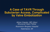 A Case of TAVR Through Subclavian Access, Complicated by Valve Embolization