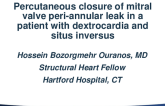 Percutaneous Closure of Mitral Valve Peri-Annular Leak in a Patient With Dextrocardia and Situs Inversus