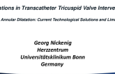 Massive Annular Dilatation: Current Technological Solutions and Limitations