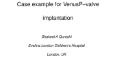 VenusP-Valve Recorded Case