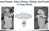 Technical Pearls: Valve Choice, Sizing, and Positioning