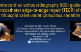 Intracardiac echocardiography (ICE) guided transcatheter edge-to-edge repair (TEER) of the tricuspid valve under conscious sedation