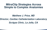Strategies across simple and complex anatomies