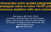 Intracardiac echocardiography guided antegrade transseptal valve-in-valve TAVR under conscious sedation with zero contrast