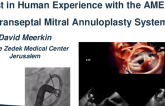 First in Human Clinical Experience With AMEND Annuloplasty for Mitral Repair