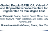 IVUS-Guided Doppio BASILICA, Valve-in-Valve, and Bioprosthetic Valve Fracture for Degenerated 19 mm Magna Ease