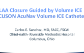 LAA Closure Guided by Volume ICE
