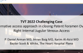 An alternative access approach in closing Patent Foramen Ovale via Right Internal Jugular Venous Access