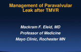 V-in-R: Post-Interventional Management of PVL