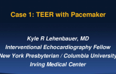 Case 1: TEER With Pacemaker