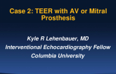Case 2: TEER With AV or Mitral Prosthesis