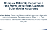 Complex MitraClip Repair for a Flail Mitral Leaflet With Calcified Sub-valvular Apparatus