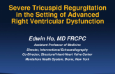 Severe TR in the Setting of Advanced RV Dysfunction (Case-based)