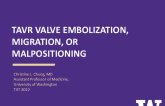 Case 4: TAVR Valve Embolization, Migration, or Malpositioning