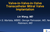Valve-in-Valve-in-Valve Transcatheter Mitral Valve Implantation to Treat Paravalvular Leak