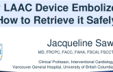 My LAAC device embolized, how to retrieve it safely!