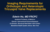 Deep Dive Into Imaging Requirements for Orthotopic and Heterotopic Tricuspid Valve Replacements
